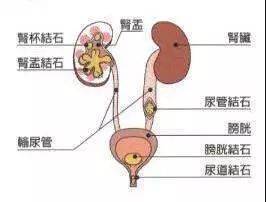 肾的两边疼是怎么回事