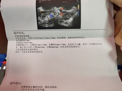 卵巢多囊样改变怎么治疗
