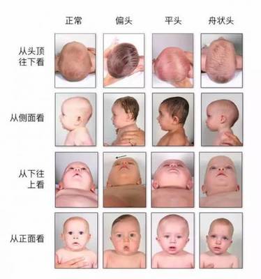 婴儿几个月头定型