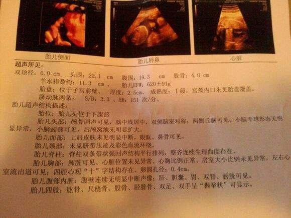 六个月胎儿双顶径标准