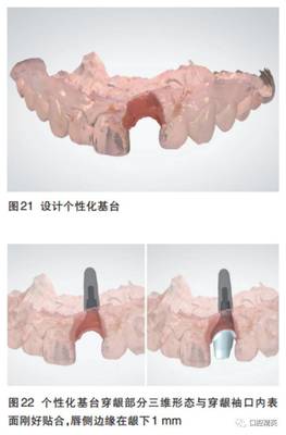 美学基台需要多少钱