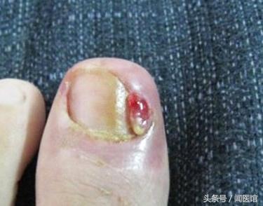 新生儿几天剪指甲
