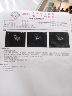 怀孕6周彩超图片