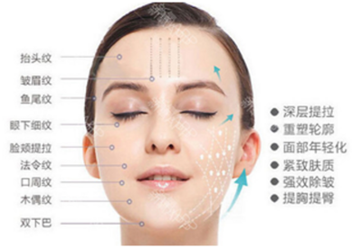 脸部埋线能维持几年