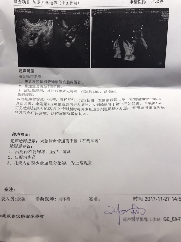 输卵管不通是怎么回事