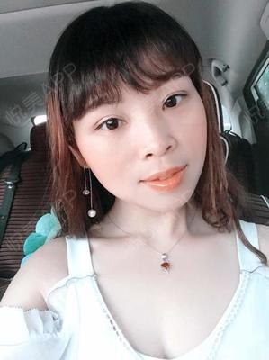 天气热割双眼皮