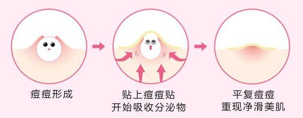 贴上痘痘贴化妆