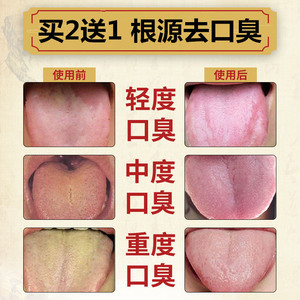 口苦舌苔白是怎么回事
