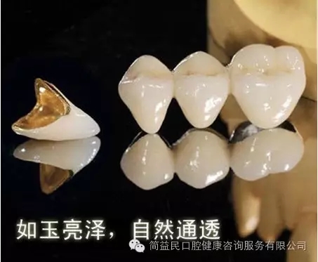 合金烤瓷牙