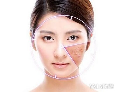 如何让脸上痘痘不复发