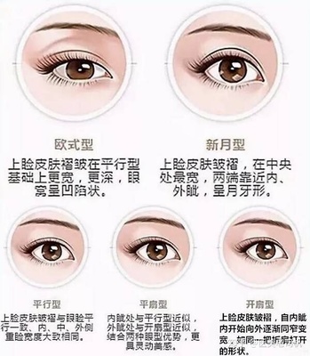 做双眼皮的形状