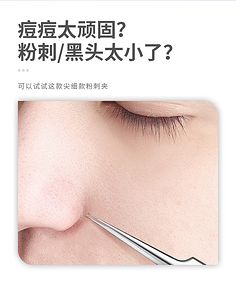 痘痘针是什么