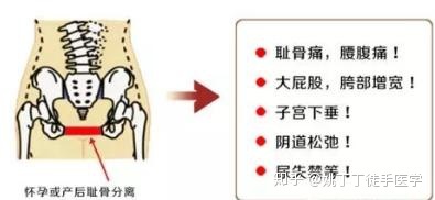 坐月子胯骨疼是怎么回事