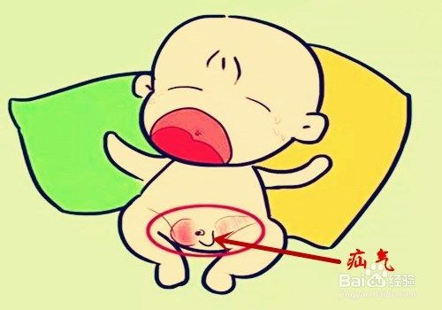 小孩疝气是怎么回事