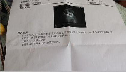 几个月才能知道怀孕