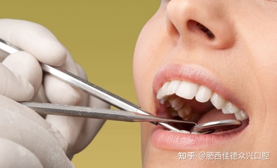 3m补牙材料价格