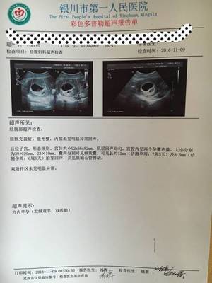 全麻之后多久可以怀孕
