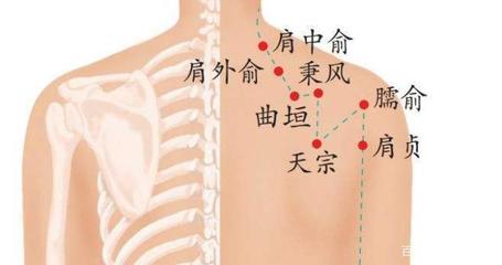 肩中俞疼是怎么回事