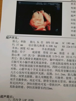 怀孕25周胎儿有多大