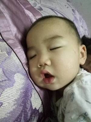九个月宝宝发烧39度