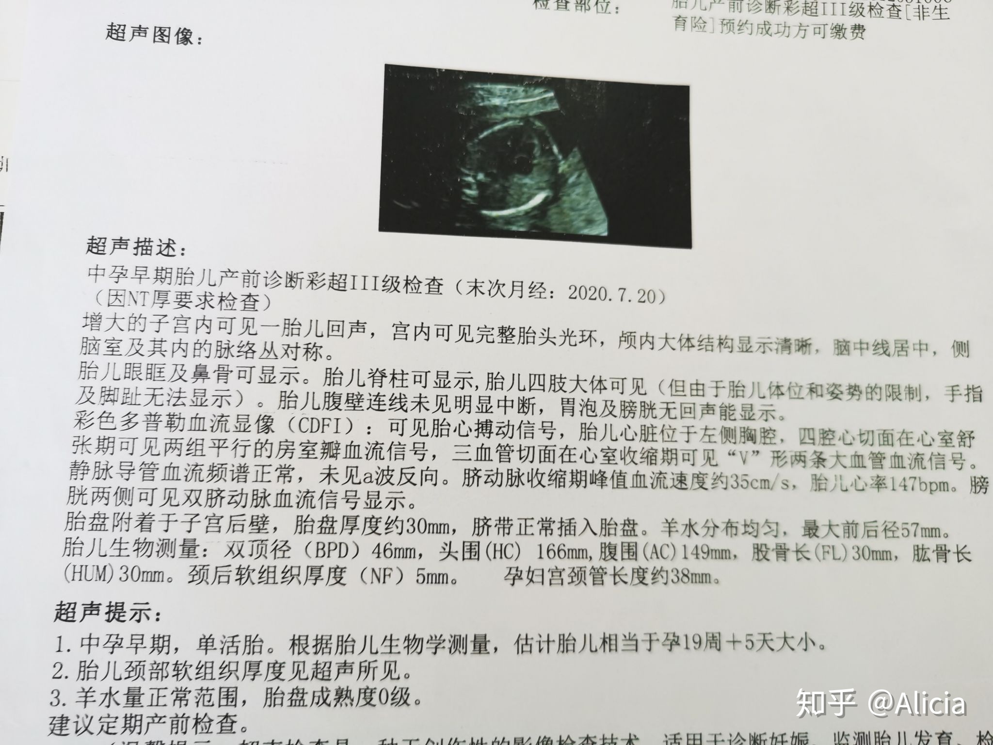 孕妇地贫对胎儿有什么影响