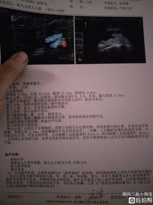 胎儿心脏彩超检查什么内容