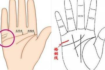 婚姻线4条