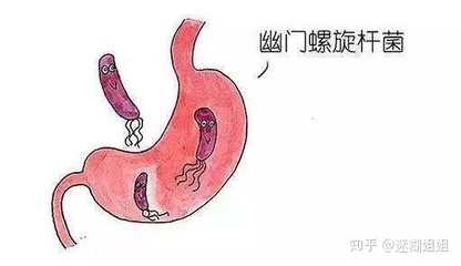 肠道有积气是怎么回事