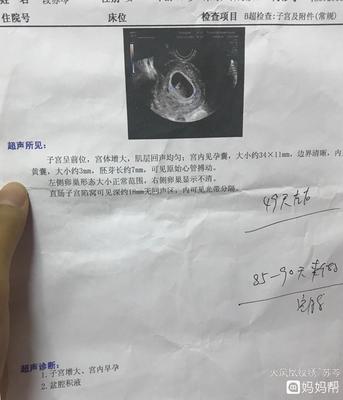 白带褐色是怀孕吗