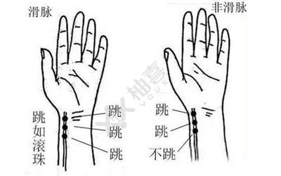 怀孕脉象图解