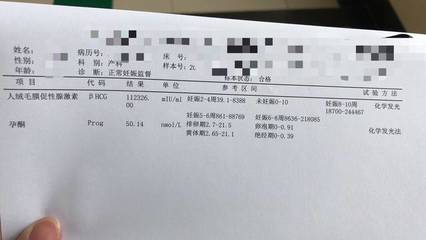 怀孕多久抽血可以检查出来