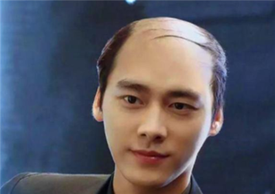头顶没头发怎么做发型
