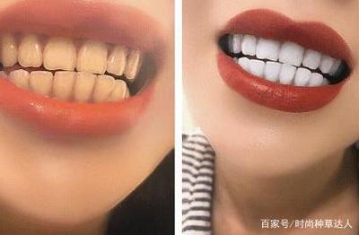 口腔里发涩是怎么回事