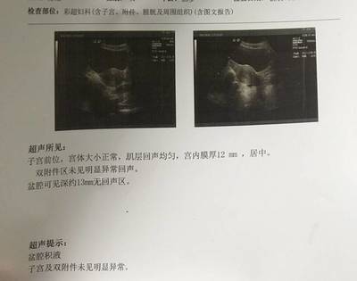 怀孕40天流产需要清宫吗