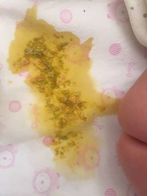 宝宝拉粑粑绿色