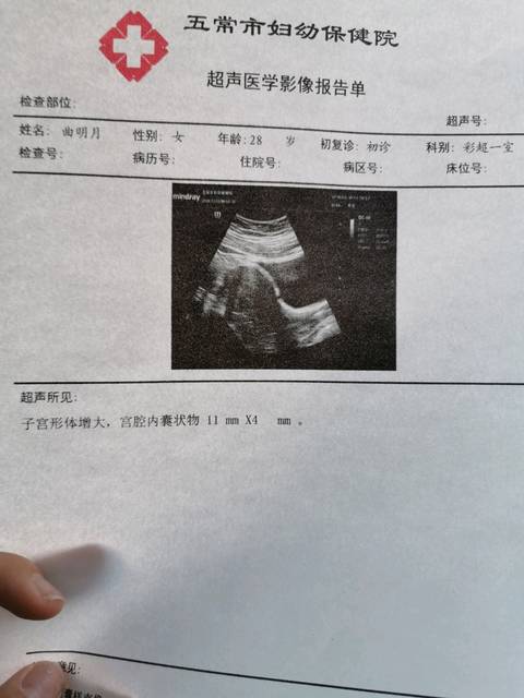 6周妊娠胎心应该多少正常