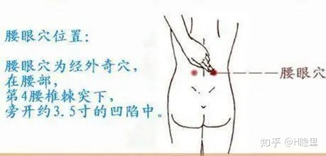腰眼子疼是怎么回事