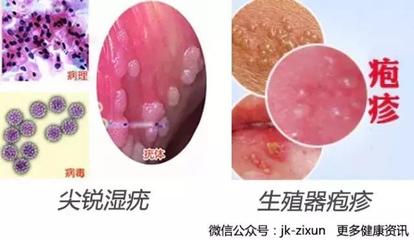 丘疹是怎么回事