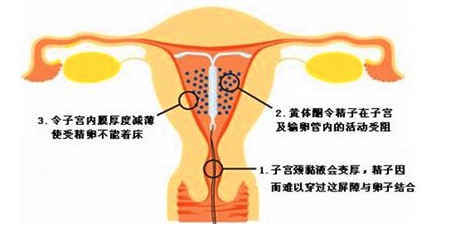 取环一个月没来月经