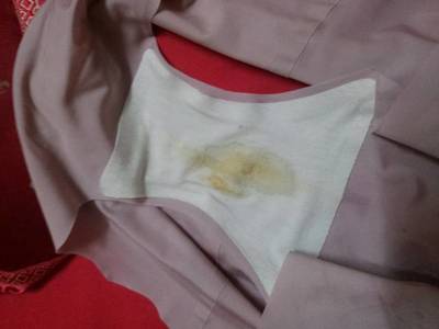 女生白带多是怀孕了吗