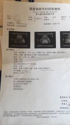 孕32周出血是怎么回事