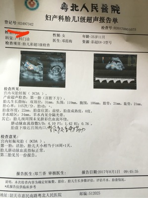 怀孕多久可以鉴定男女