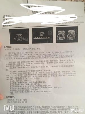 尾椎骨骨折怎么治疗