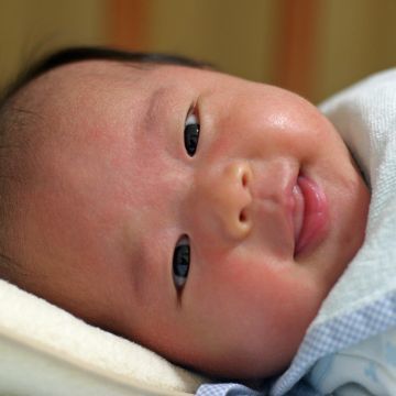 新生儿42天黄疸多少算正常