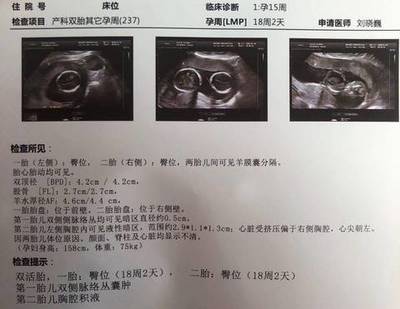 18周胎儿真实图