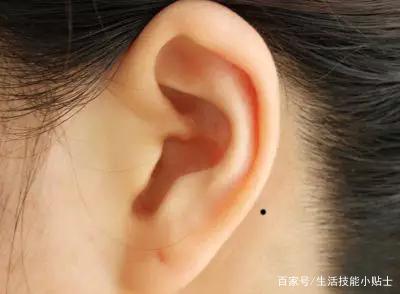 右耳朵边有痣代表什么意思