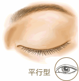双眼皮哪种类型好看