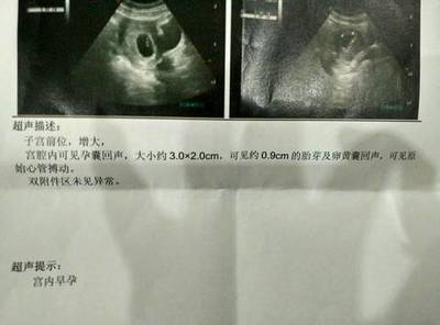 怀孕前会出血吗