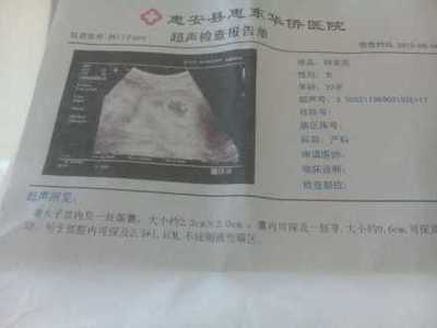 怎么测试男女宝宝最准