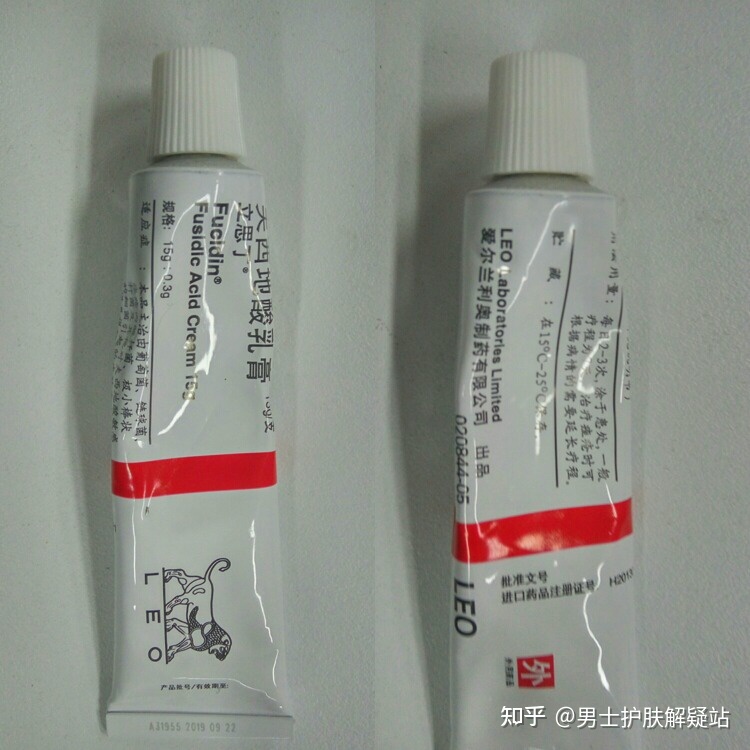 祛痘印的药膏有哪些